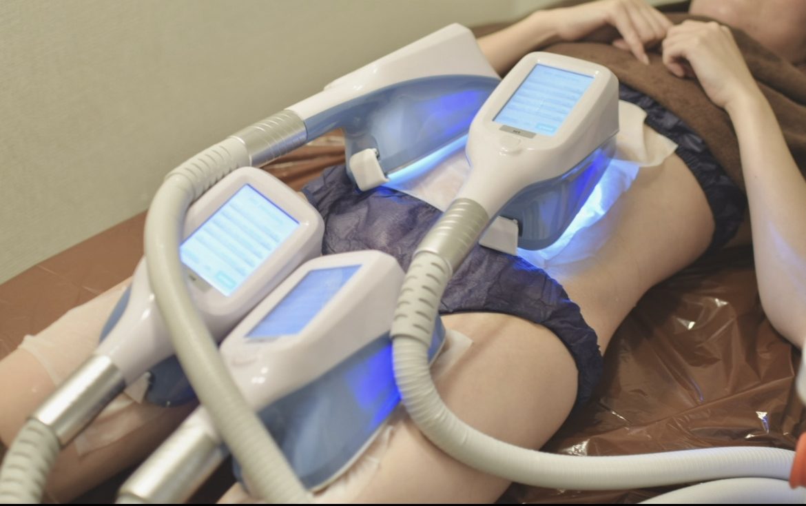 お腹まわりに脂肪冷却のカップを当てている様子